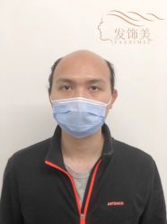 -发饰美男士增发补发假发定制店