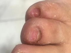 -Andrew指甲专科灰指甲·甲沟炎矫正·3D步态矫形鞋垫定制(浦三路店)