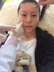 点击看大图 iphone_upload_pic-芷妍医美