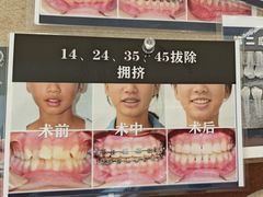 -大白象口腔连锁·矫正·种植中心(玺悦城店)
