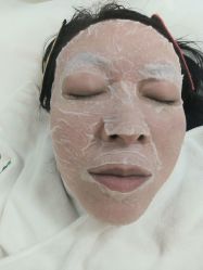 -新雨池不针清祛痘