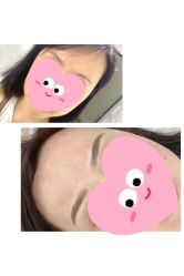 -Doris多里斯半永久纹眉·SMP纹发·发际线