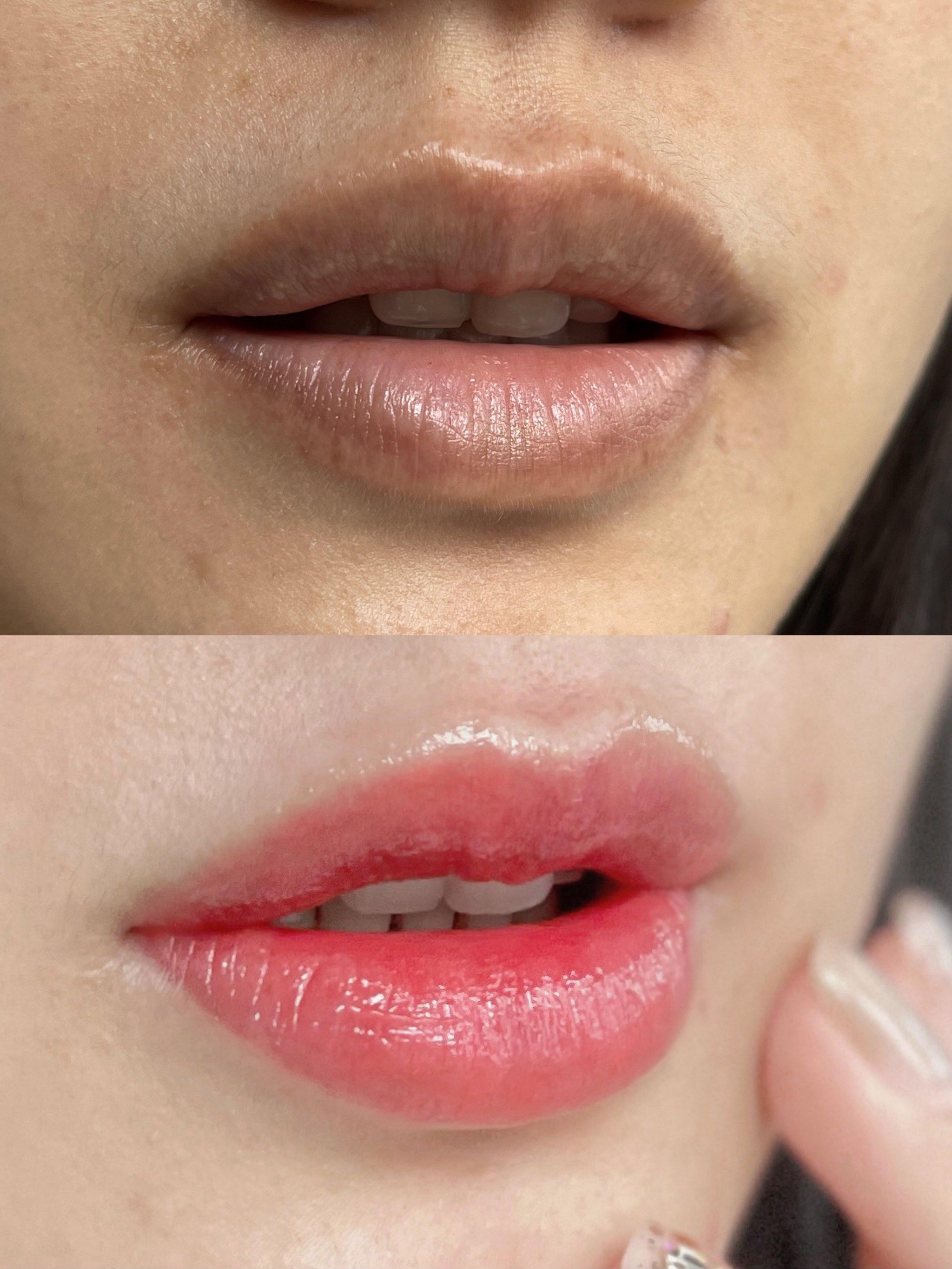 部色素矫正 解决了一直以来乌唇带来的困扰 只能一直涂很深的口红盖着