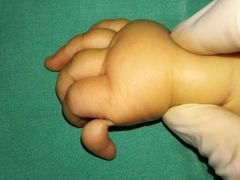 -华中科技大学同济医学院附属协和医院(主院区)