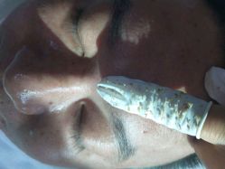 -荟草堂专业祛痘修护中心