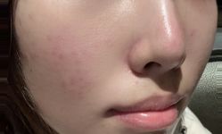 点击看大图 -铂特丽医美·眼鼻整形·光电美肤·注射抗衰