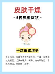 -克丽缇娜