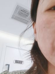 体验后-海涛医疗美容·面部抗衰·注射美鼻