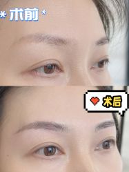 -张小野·专业半永久纹眉