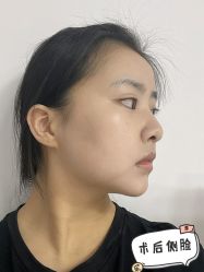 -深圳艺星医疗美容医院