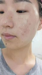-蕾特恩专业祛痘·皮肤管理