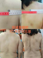 -丽减美瘦吧·减肥瘦身