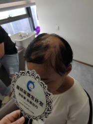 -唐风采假发补发定制