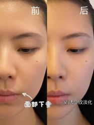 -ST时柒·问题肌抗衰美颜所