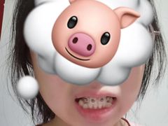 -极光口腔·矫正种植修复(锦江店)