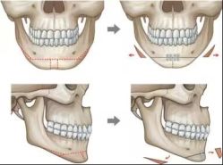 -圣嘉新医疗美容医院