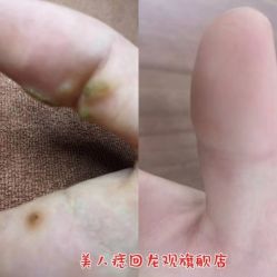 -美人痣全国连锁