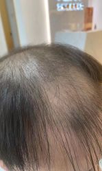 -发饰美男士增发补发假发定制店
