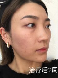 -广州美莱医疗美容医院