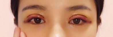 -斐研美医疗美容·眼周抗衰中心