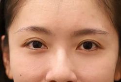体验后-南京康美美容医院·旗舰店
