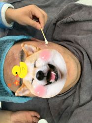 -欣奕除疤祛痘