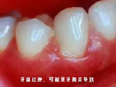 -团圆口腔·种植中心(锦江院区)