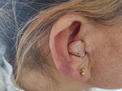 -惠耳听力助听器(信阳中山南路店)