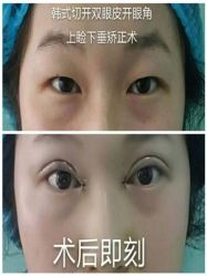 -美莱医学美容医院