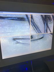 洗后检测结果-仙娜健康管理中心