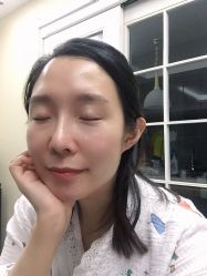体验后-亿美医疗美容·半岛大超炮官方授权店