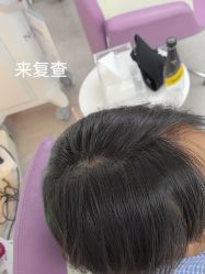 -北京雍禾植发医院