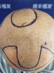 -雍禾植发全国连锁