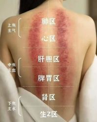 -克丽缇娜