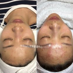 -Hi Beauty Skin 科技美肤中心