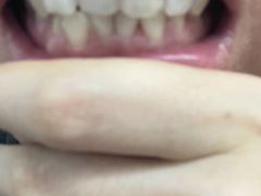 -微笑牙科口腔(三亚迎宾院区)