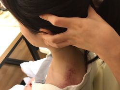 -溢美古法抗衰