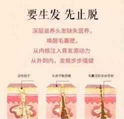 -诗碧曼养发