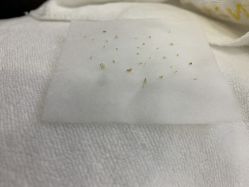 -蕾特恩专业祛痘·皮肤管理