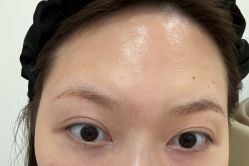 -广州健丽·去眼袋医疗美容机构