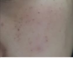 -圣嘉新医疗美容医院