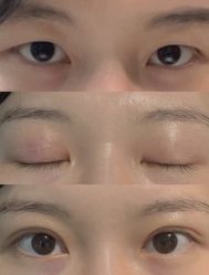 -上海漾颜医疗美容