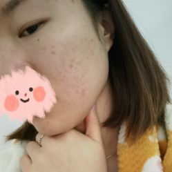 体验后-贞禾医美·连锁