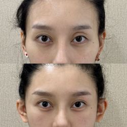 -Yestar重庆艺星医疗美容医院