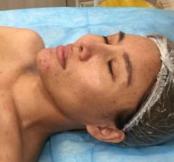-深圳悦她医疗美容