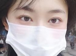 体验后-安徽合肥韩美整形外科医院