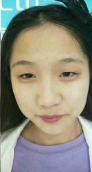 -安徽合肥韩美整形外科医院