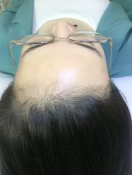 -RC半永久纹眉纹发际线