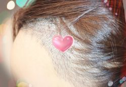 -大麦微针植发全国连锁