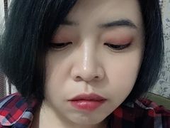 -黑马眼科·近视手术